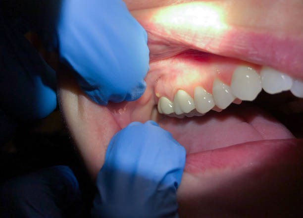 Best Emergency Gum Pain Relief  in Oak Grove, AL