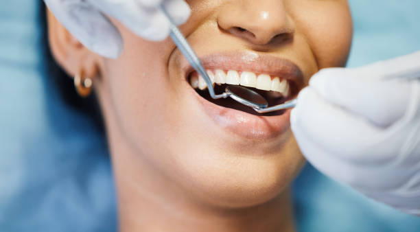 Dentist for Dental Trauma in AL