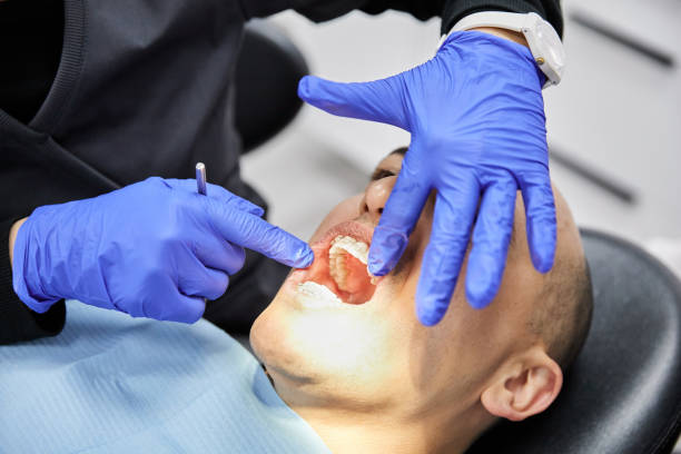 Best Chipped Tooth Repair Near Me  in Oak Grove, AL